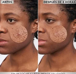 GARNIER Hidratantes Faciales<8 Hours Pimple Patch