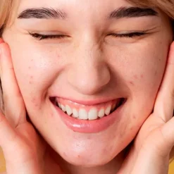 ARMONIA Ampollas|Ácido Glicólico<Ampolla Aha's Naturales