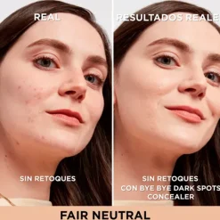 IT COSMETICS Correctores De Maquillaje<Bye Bye Dark Spots Concealer + Serum