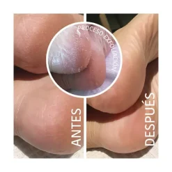 IROHA NATURE Mascarillas|Facial<Calcetines Mascarilla Exfoliante