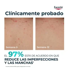 EUCERIN Hidratantes Faciales|Acné<Dermopure Oil Control Crema Corporal