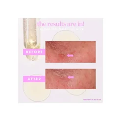 HELLO SUNDAY Serums|Serum Antimanchas<Makes You Glow F4