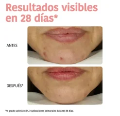 IROHA NATURE Mascarillas|Facial<Mascarilla Peeling Piel Perfecta