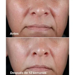 CLINIQUE Antiedad|Hidratantes Faciales<Smart Clinical Repair Rich Cream