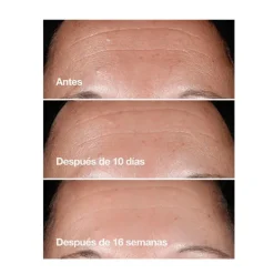 Sale Smart Clinical Repair™ Serum Serums