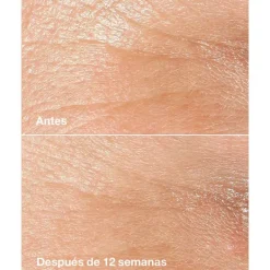 CLINIQUE Antiedad|Hidratantes Faciales<Smart Clinical Repair Wrinkle Correcting Cream