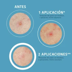 IROHA NATURE Hidratantes Faciales|Ácido Salicílico<Sos Pimple Patches