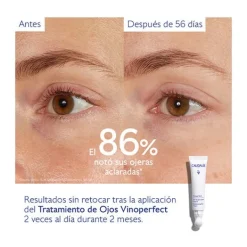 CAUDALIE Hidratantes Faciales|Ojos<Vinoperfect