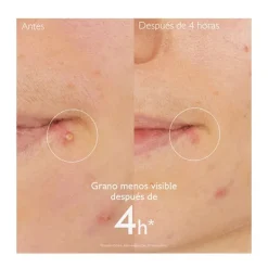 CAUDALIE Hidratantes Faciales|Piel Grasa<Vinopure