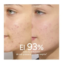 CAUDALIE Hidratantes Faciales|Piel Grasa<Vinopure